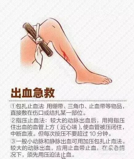 止血急救.jpeg