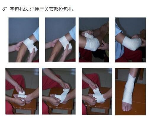 八字包扎.jpg